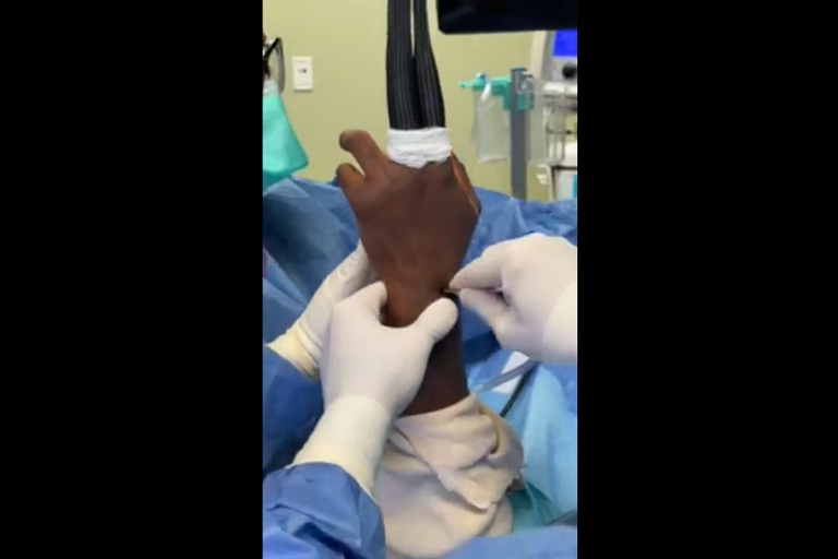 #LivesurgeryTuesday Recap: Arthroscopic Wrist Ganglion Cyst Excision